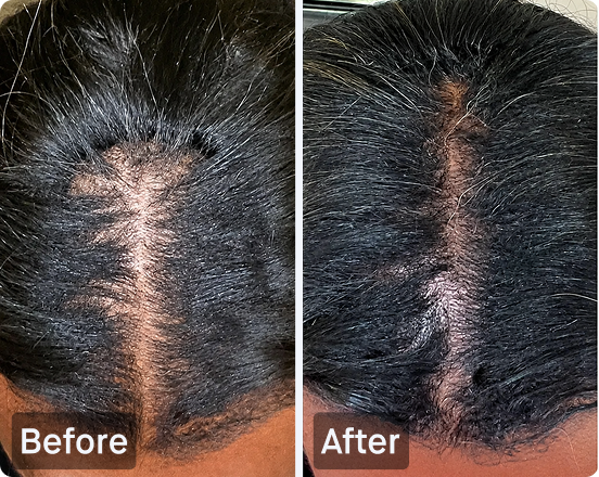 I34 TruFolix Hair Growth & Strengthening Liquid