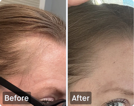 I34 TruFolix Hair Growth & Strengthening Liquid
